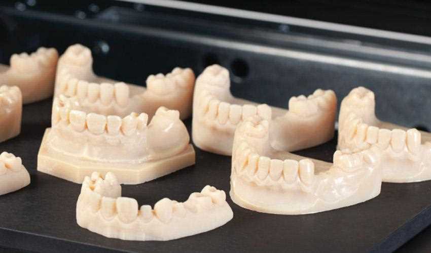 Применение 3D-принтеров в стоматологии: особенности технологии и преимущества